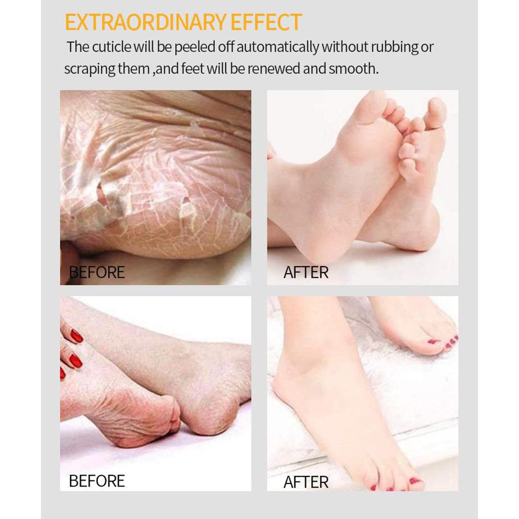 Exfoliating Peel Foot Mask Baby Soft Remover Dead Skin Cracked Heel Rose