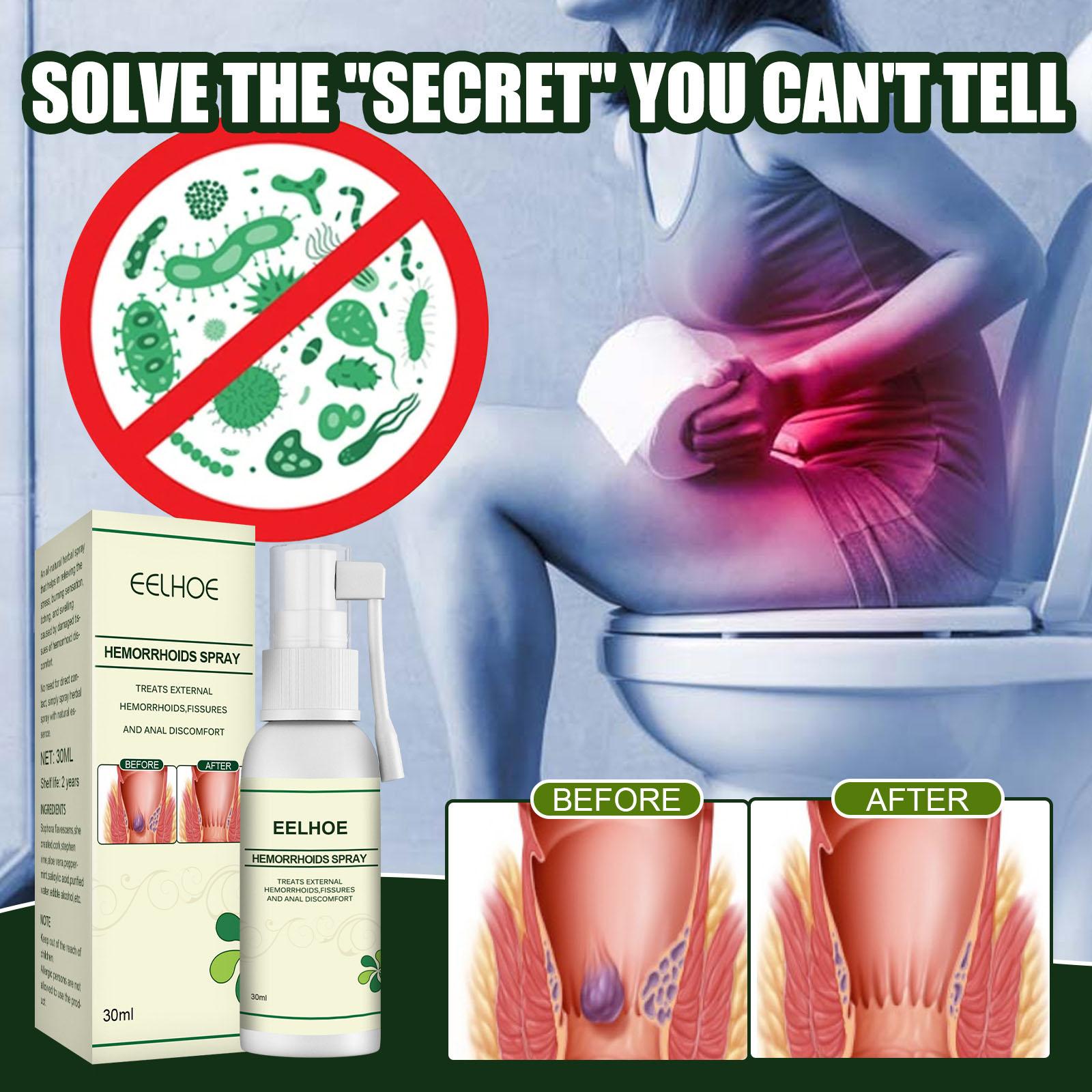 Hemorrhoids Spray 30ml Powerful Gentle for Itchy Alleviate Pain Women Men