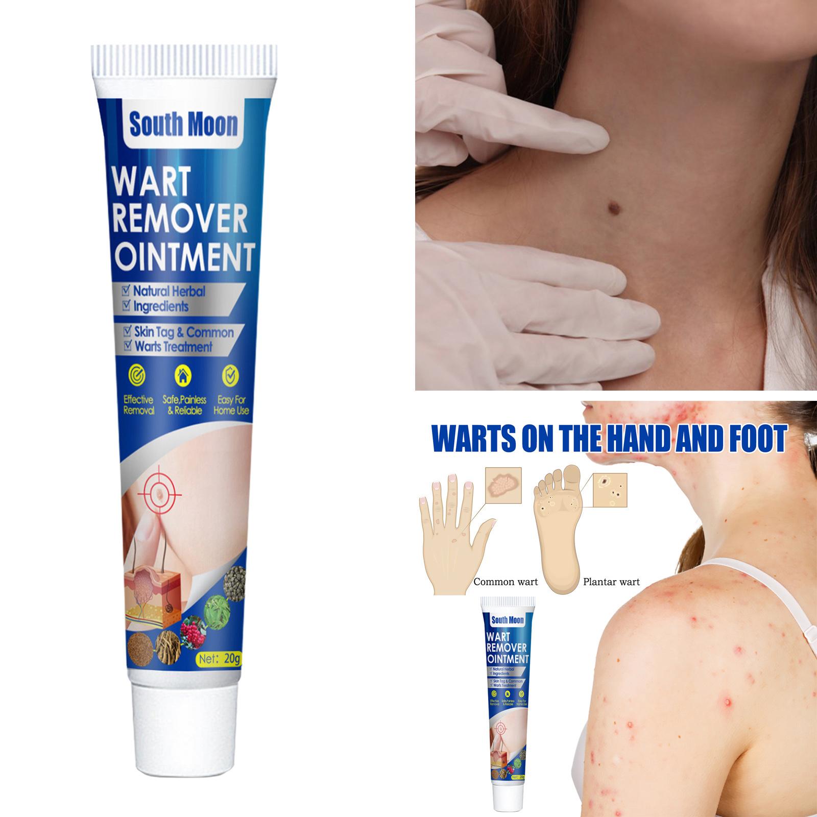 20G Wart Treatment Cream Skin Tag Removal Plaster Warts Remover for Unisex
