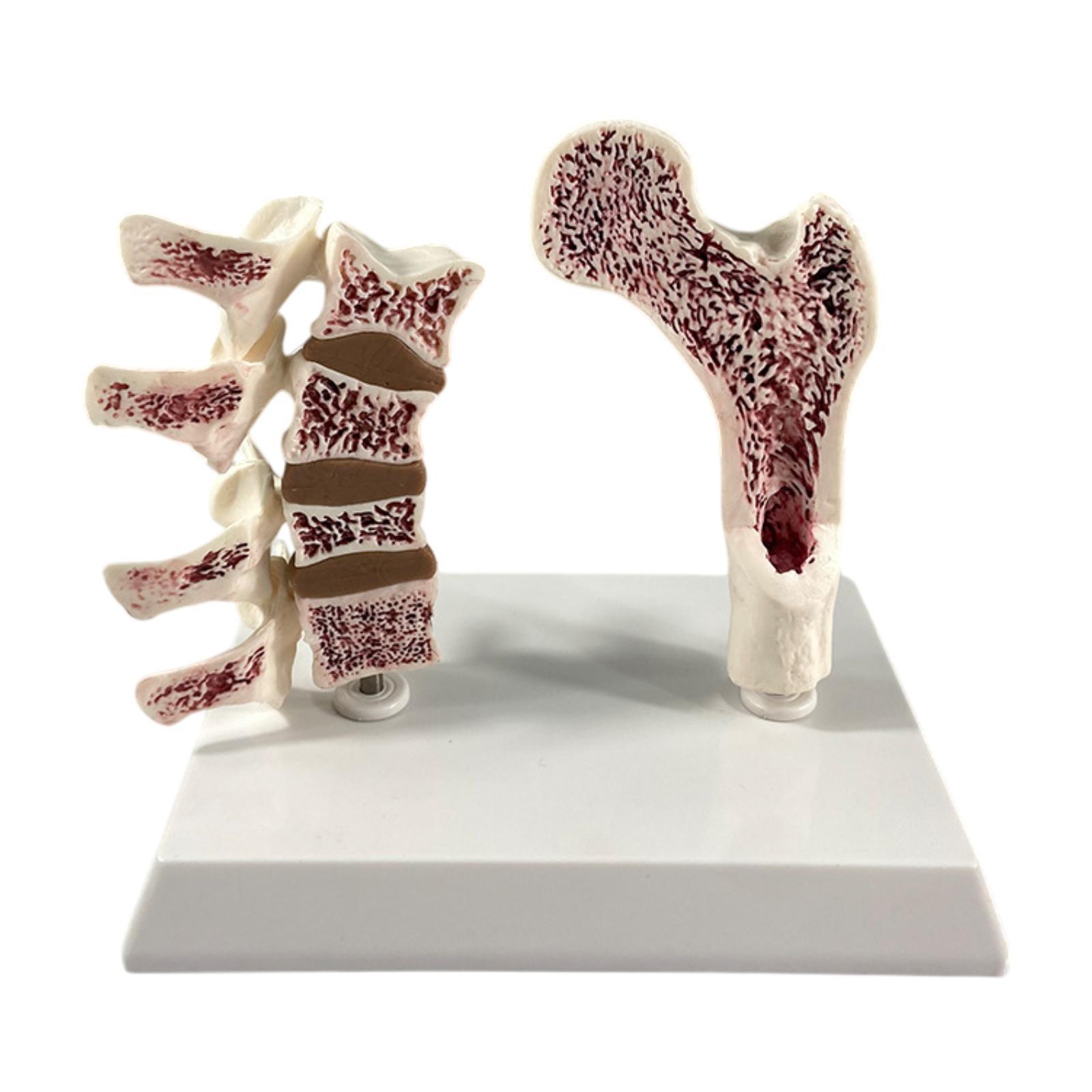 Femur Anatomy Model