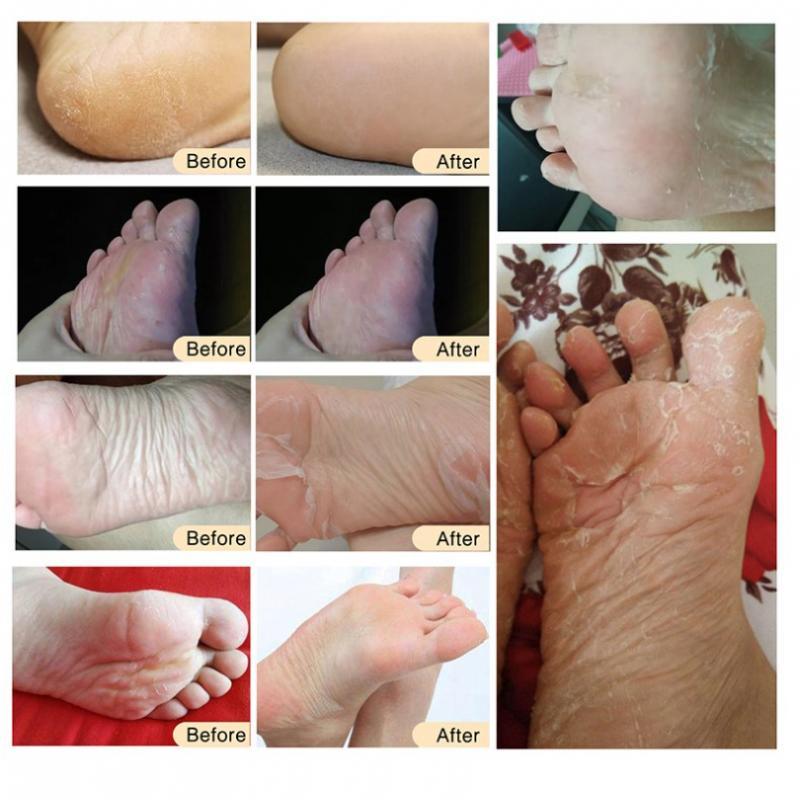 Baby Soft Foot Peeling Mask Socks Exfoliating Callus Dead Skin Rose