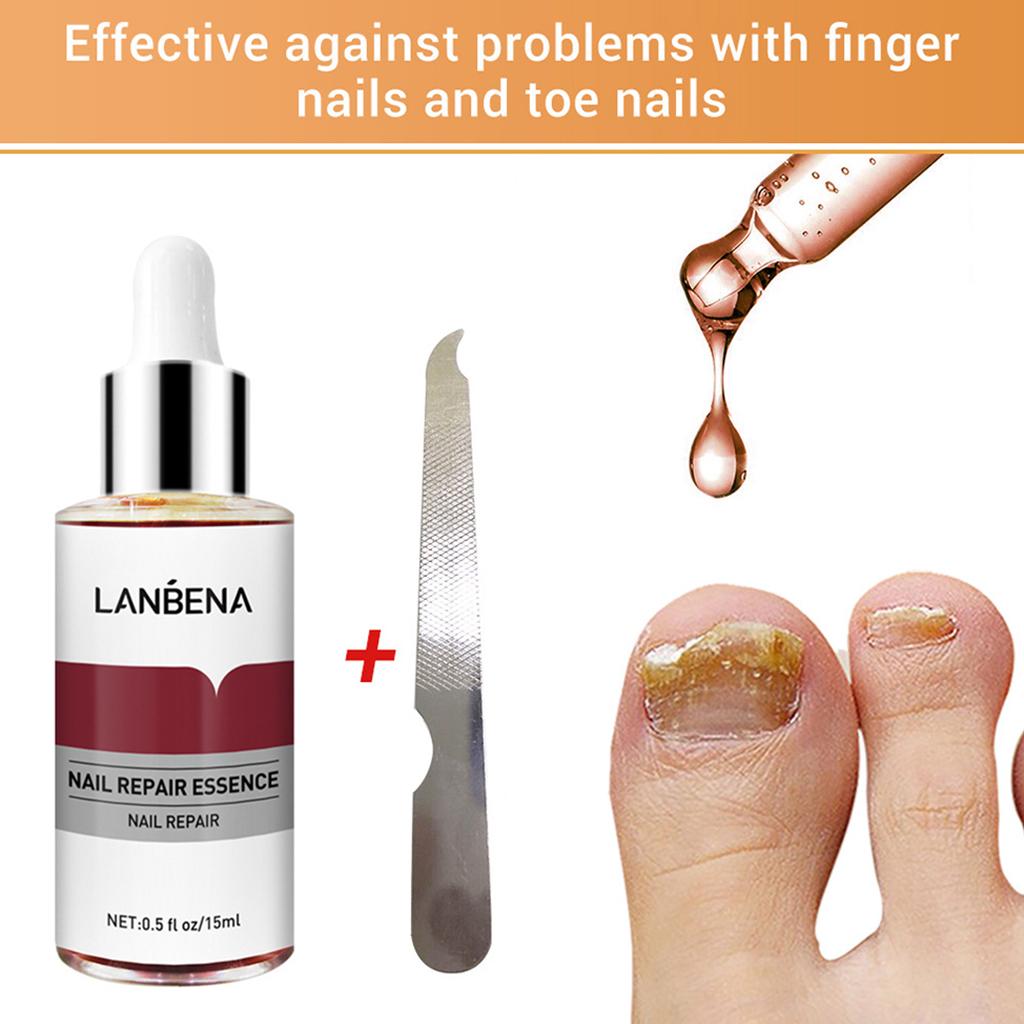Nail Repair Essence Moisturize Nail Art Care Nourish for Dry Cracked Cuticle