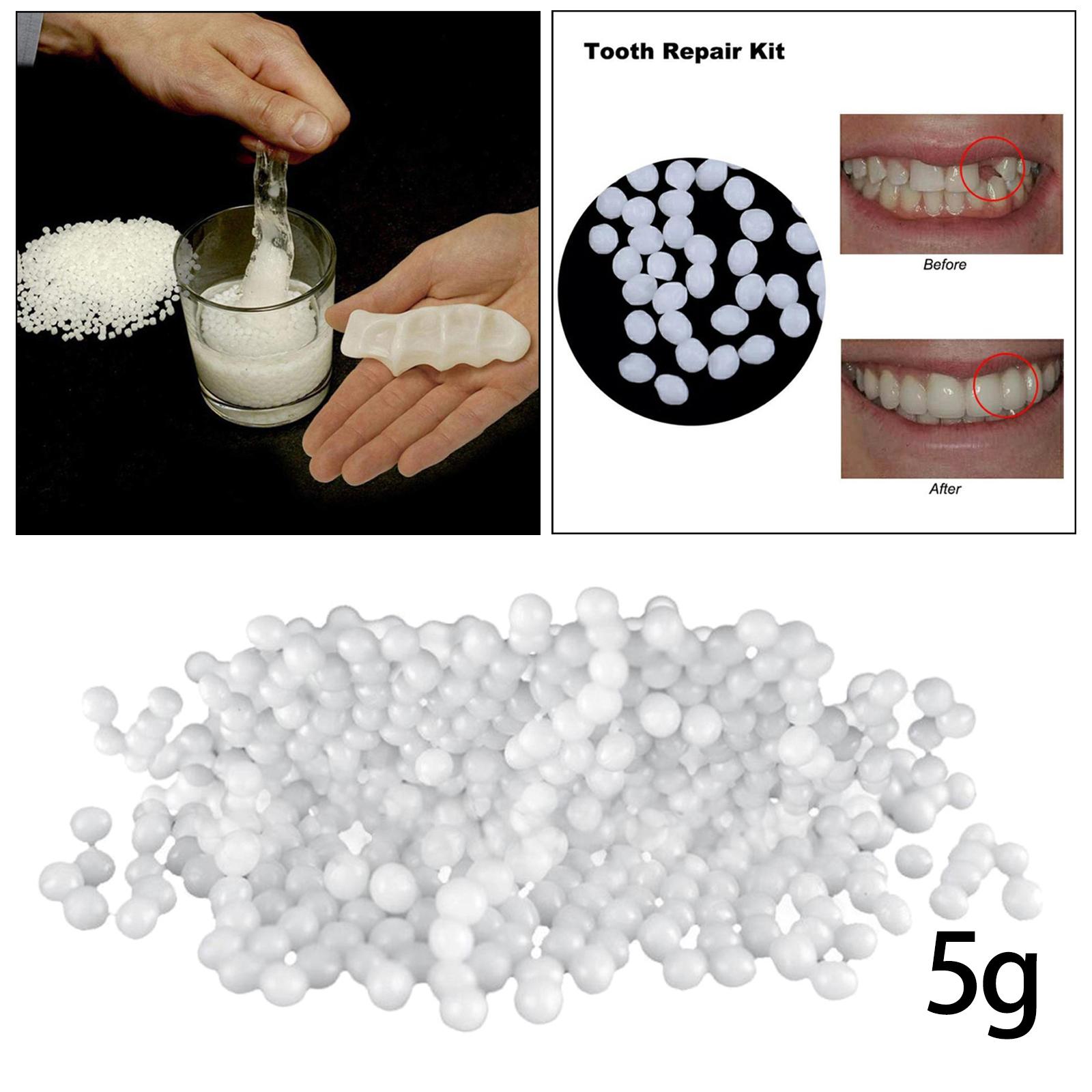Temporary Teeth Repair Kit Filling Fix The Missing and Broken Tooth Moldable