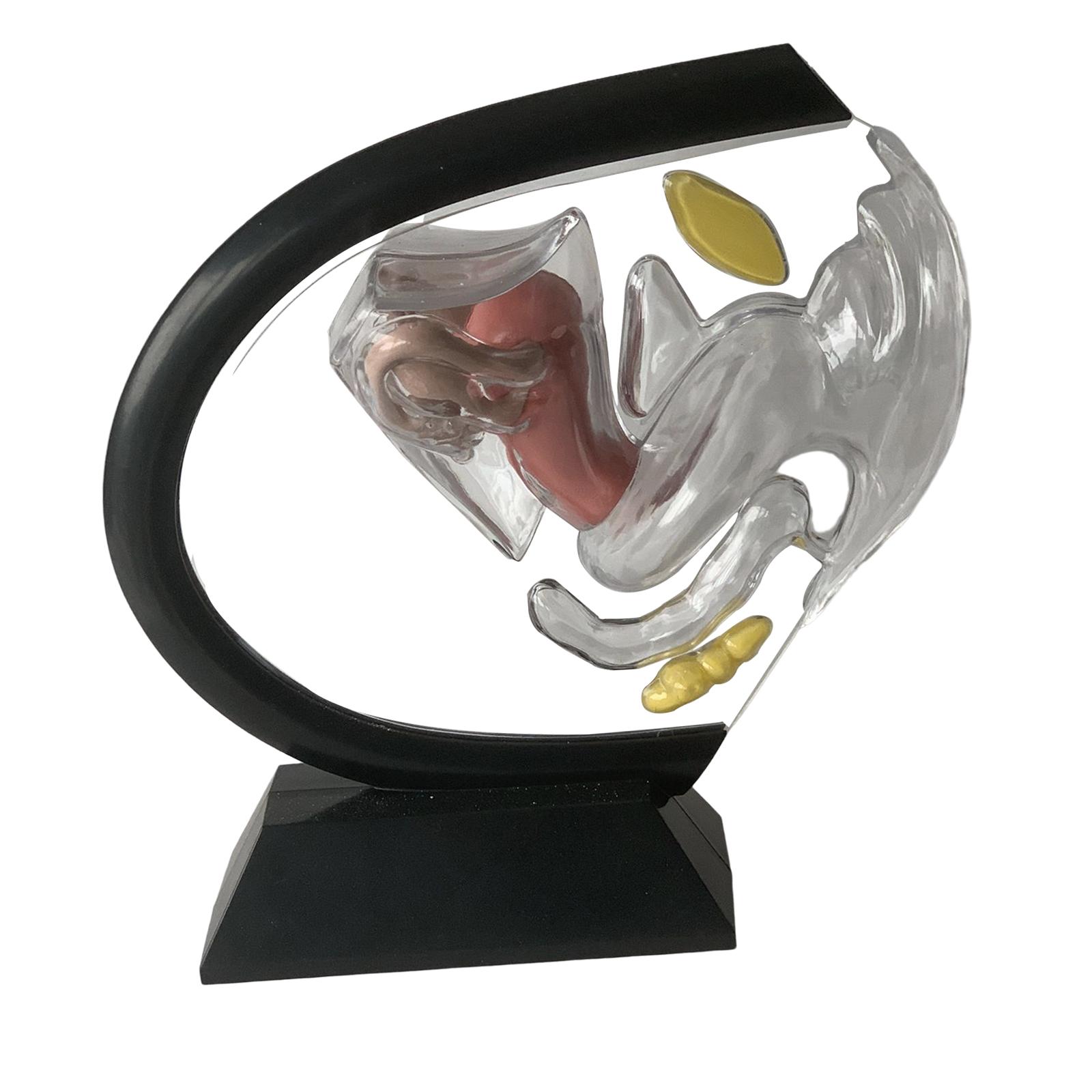 Uterus Model