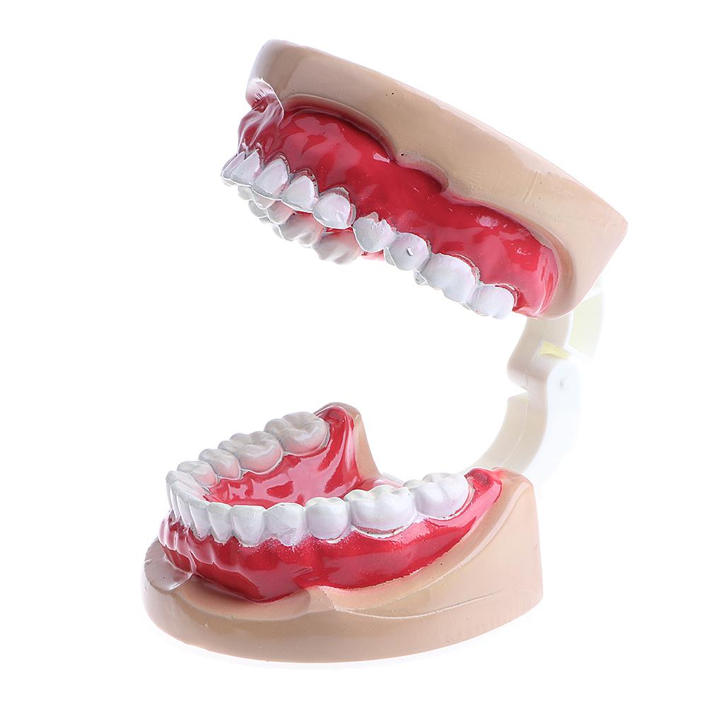 2X Large Children Dental Teeth Model Dentist Teaching Oral Hygiene Tool