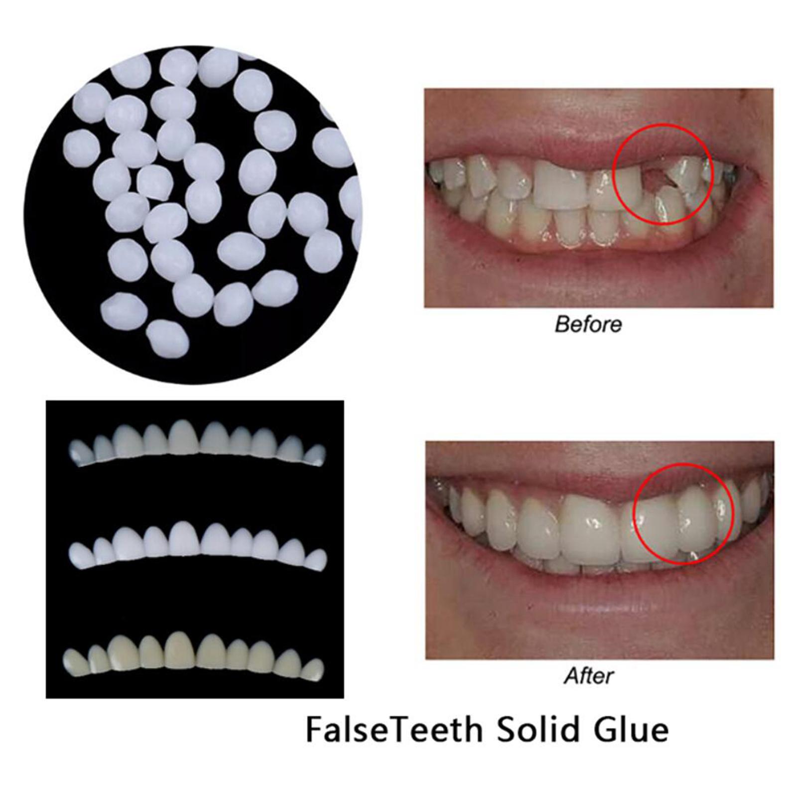 Moldable Teeth Veneers with Adhesive Fitting Beads Temporary False Teeth