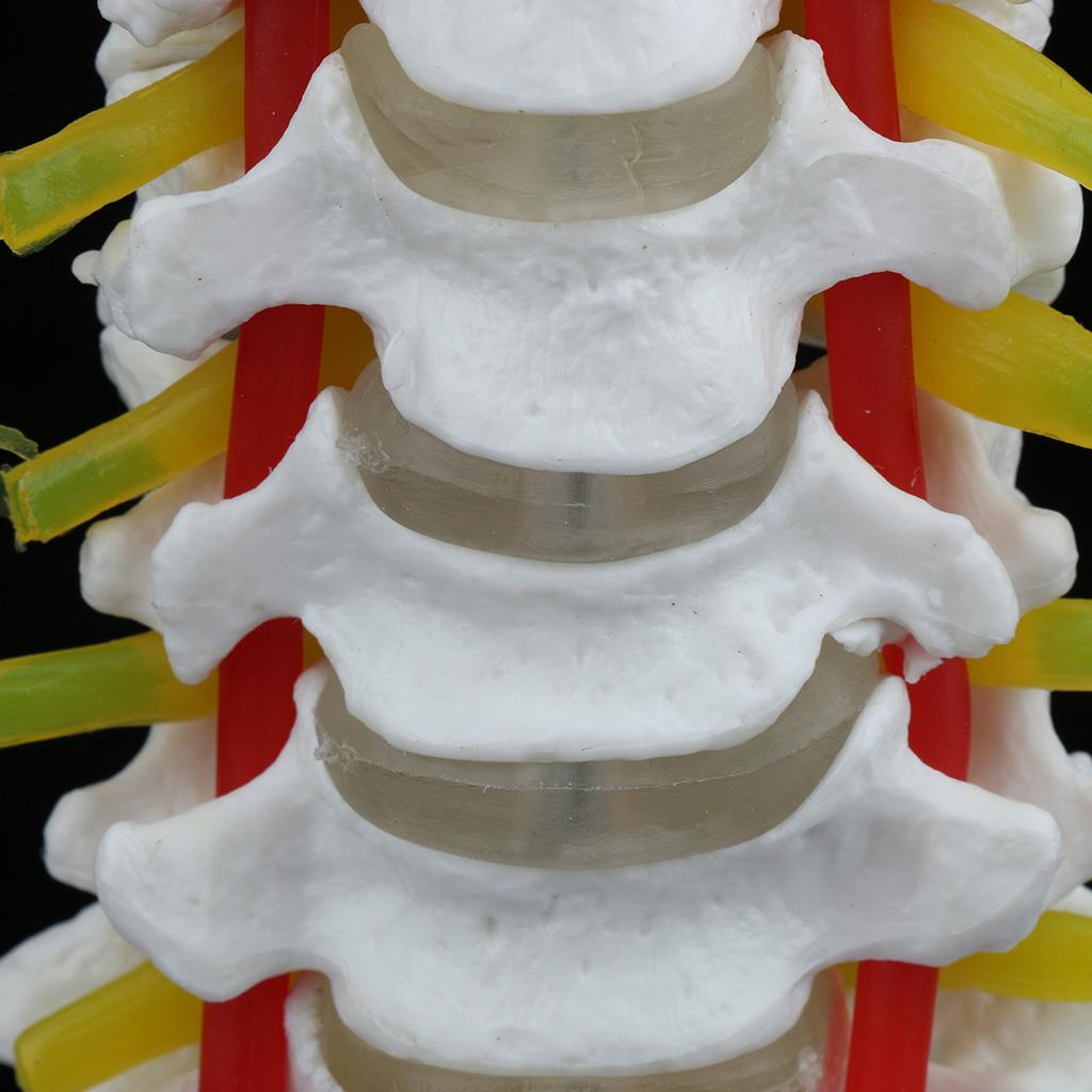 1:1 Human Cervical Vertebra Carotid Artery Flexible Model  Study 